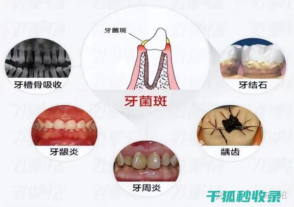 牙刷更换周期：为什么说每三个月换一次很重要？ (牙刷更换周期多久)